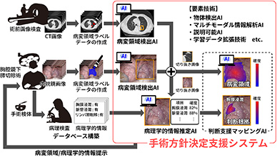 手術方針決定支援システム